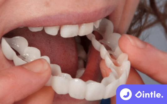 Unlock the Secret to a Hollywood Smile with This Simple Trick: Snap-On Veneers